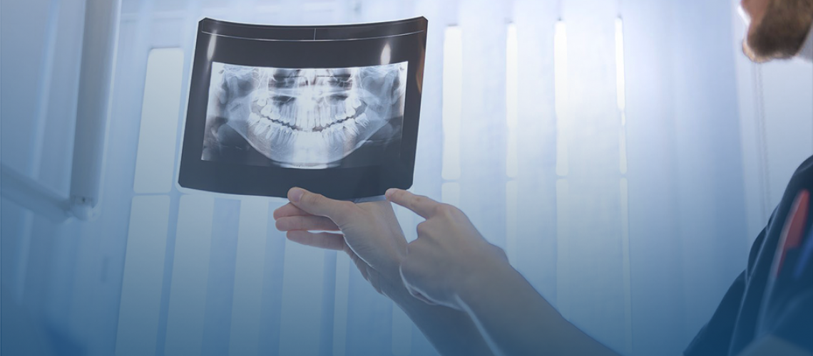 Radiografia Digital na Odontologia: Tecnologia em benefício dos pacientes