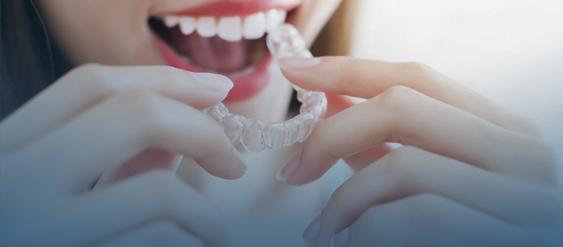 Invisalign o que é?